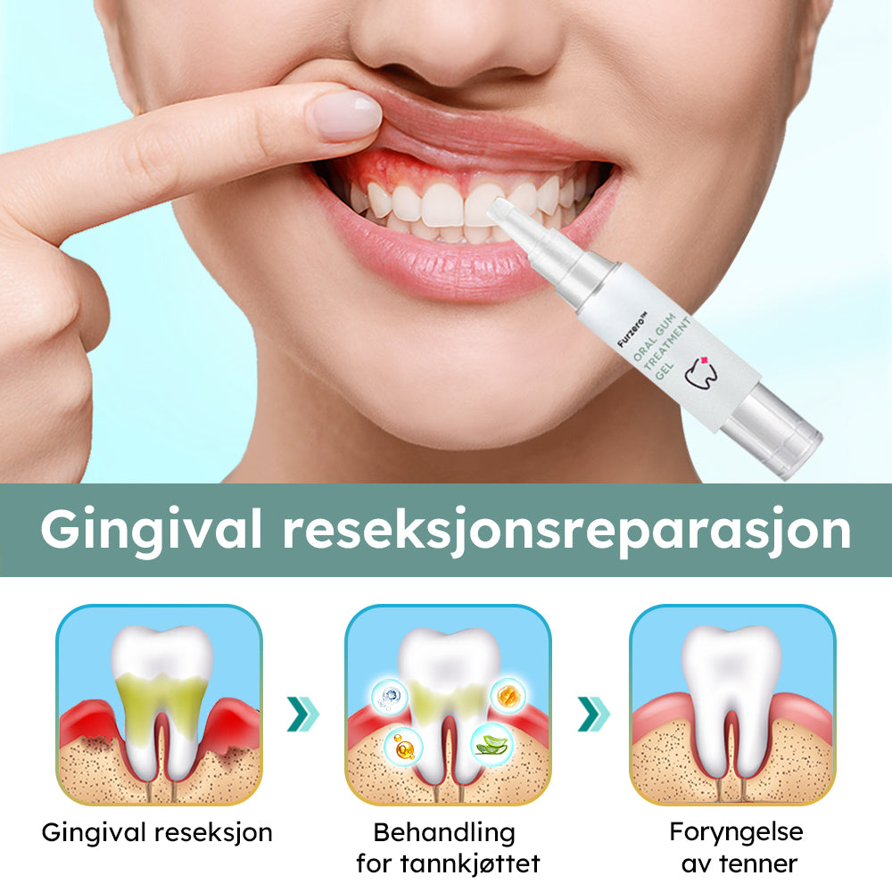 Furzero™ Oral tannkjøttbehandling Gel (C-vitamin)