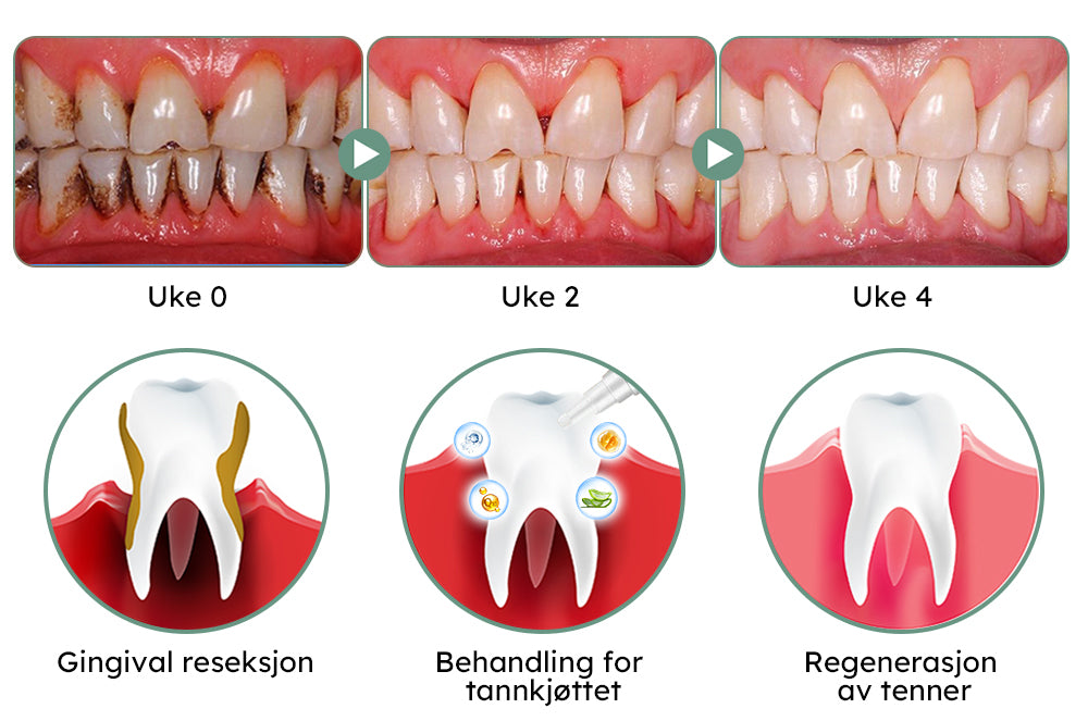 Furzero™ Oral tannkjøttbehandling Gel (C-vitamin)