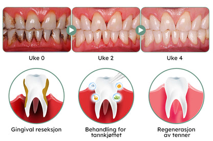 Furzero™ Oral tannkjøttbehandling Gel (C-vitamin)